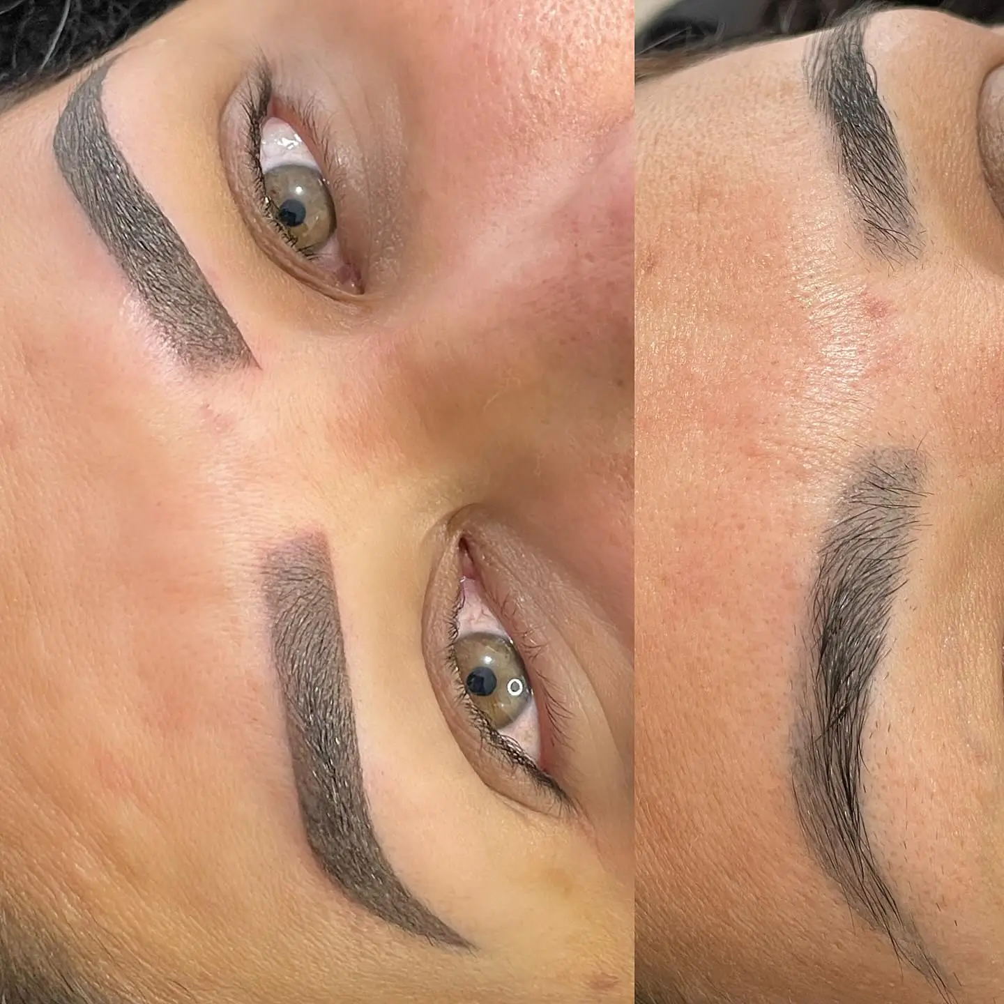 Procedimento Estética Facial